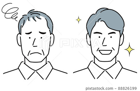 The head of a middle-aged man suffers from thinning hair. 88826199