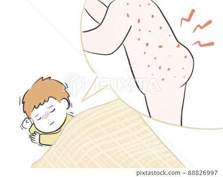 A suffering child who cannot sleep due to itching of atopy 88826997