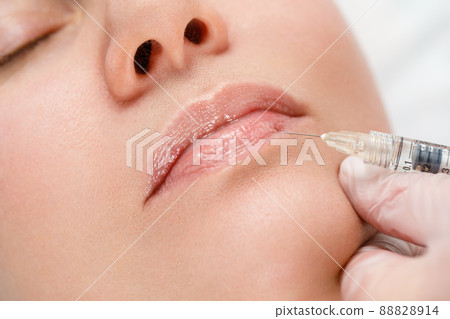 Lip shape correction procedure in a cosmetology salon. The specialist makes an injection on the lips of the patient. Lip augmentation. Lip shape correction procedure in a cosmetology salon. The specialist makes an injection on the lips of the patient. Lip augmentation. 88828914