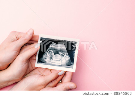 Ultrasound image pregnant baby photo. Woman hands holding ultrasound pregnancy picture on pink background. Pregnancy, medicine, pharmaceutics, health care and people concept. Ultrasound image pregnant baby photo. Woman hands holding ultrasound pregnancy picture on pink background. Pregnancy, medicine, pharmaceutics, health care and people concept. 88845863