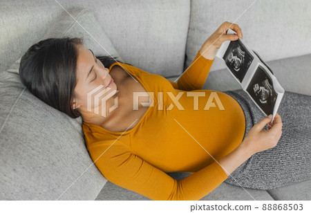 Baby ultrasound scan. Pregnant Asian woman holding hospital picture result from health checkup with small belly happy of first pregnancy 88868503