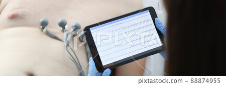 Doctor taking cardiogram to sick patient man on digital tablet in clinic closeup 88874955