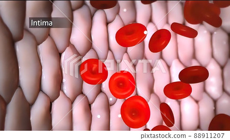 Aortic aneurysm and aortic dissection 88911207