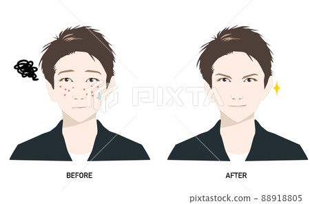 Before and After Men's Skin Care for Men Suffering from Acne __ 88918805