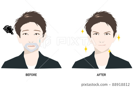 Men before and after suffering from blue beard __ Men's skin care 88918812