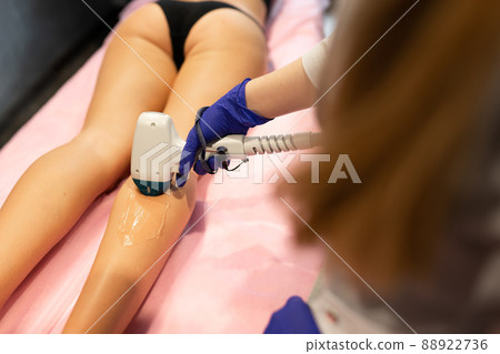 Laser depilation leg hair removal therapy 88922736