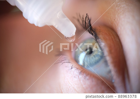 Drops from vial dripping into woman eye closeup 88963378