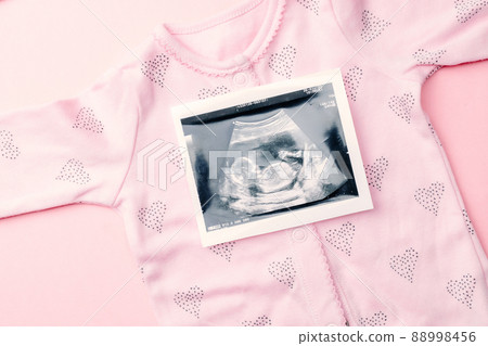 Ultrasound photo pregnancy baby. Fashion cute baby cloth with ultrasound pregnancy picture on pink background. Concept of pregnancy, maternity, expectation for baby birth. Ultrasound photo pregnancy baby. Fashion cute baby cloth with ultrasound pregnancy picture on pink background. Concept of pregnancy, maternity, expectation for baby birth. 88998456