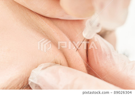 Injection at spa salon. Doctor hands in gloves. Closeup. Pretty female patient Injection at spa salon. Doctor hands in gloves. Closeup. Pretty female patient 89026304
