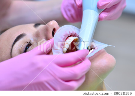 Doctor examining patient teeth with intraoral 3d scanner. Doctor examining patient teeth with intraoral 3d scanner. 89028199