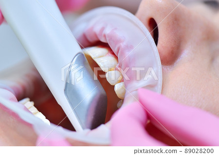 dentist doing dental scanning of patients teeth dentist doing dental scanning of patients teeth 89028200