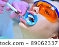 Dentist applies whitening gel to patient's teeth in dental clinic. 89062337