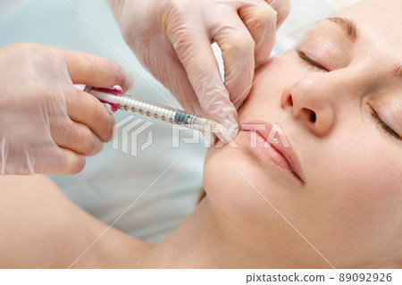 A woman makes lip shape correction in a cosmetology clinic. Lips injections, lip augmentation. A woman makes lip shape correction in a cosmetology clinic. Lips injections, lip augmentation. 89092926