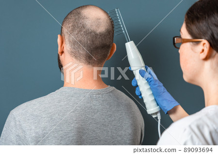 A man with baldness on his head during the procedure with the Darsonval device at the trichologist. Rear view. Turquoise background. The concept of alopecia and professional treatment A man with baldness on his head during the procedure with the Darsonval device at the trichologist. Rear view. Turquoise background. The concept of alopecia and professional treatment 89093694