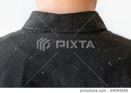 Close up view of person's shoulders in black shirt covered with dandruff. Copy space. The concept of psoriasis and seborrheic dermatitis Close up view of person's shoulders in black shirt covered with dandruff. Copy space. The concept of psoriasis and seborrheic dermatitis 89093698