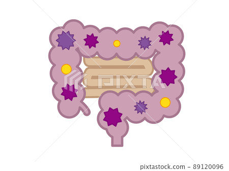 Unhealthy large intestine 89120096