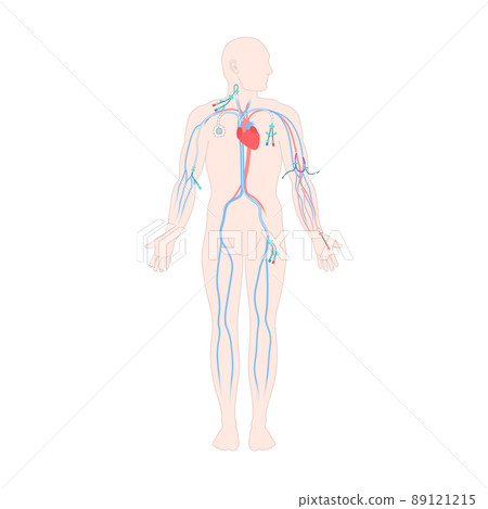 Central line venous catheter types on male body 89121215