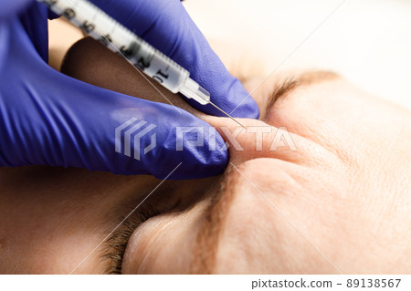 A cosmetologist performs a procedure of rejuvenating injections for the face to tighten and smooth out wrinkles on the skin of a woman's face. Cosmetic skin care in a beauty salon. 89138567