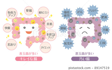 Intestine illustration Intestine with lots of good bacteria Intestine with lots of bad bacteria 89147519