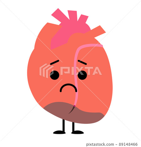 Heart where myocardium is necrotic due to myocardial infarction 89148466