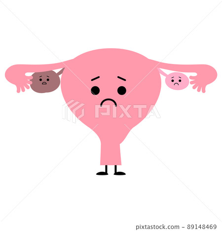 Ovarian cyst, worried uterus Ovarian cyst, worried uterus 89148469