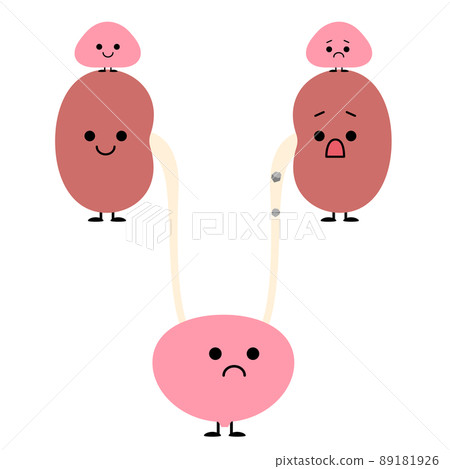 泌尿小組擔心輸尿管結石的移動 泌尿小組擔心輸尿管結石的移動 89181926