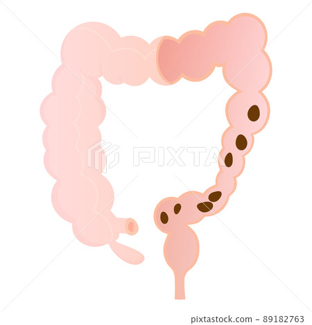 Vector illustration of convulsive constipation. Vector illustration of convulsive constipation. 89182763