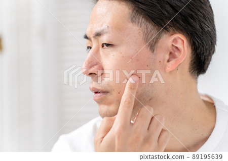 Men's Beauty Rough Skin Acne Beard 89195639