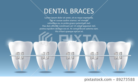 Dental braces vector poster banner design template Dental braces vector poster banner design template 89273588