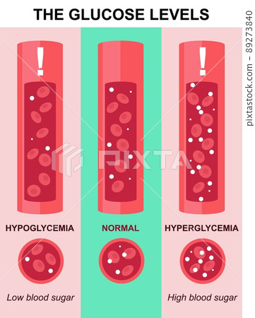 Glucose level test in blood vector lab analysis Glucose level test in blood vector lab analysis 89273840