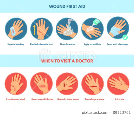 Aid skin wound. First aids stop bleeding, infographic types emergency treatment damaged hands cut infected injury, steps medical dressing, pain injuries after accident, neat vector Aid skin wound. First aids stop bleeding, infographic types emergency treatment damaged hands cut infected injury, steps medical dressing, pain injuries after accident, neat vector 89313761