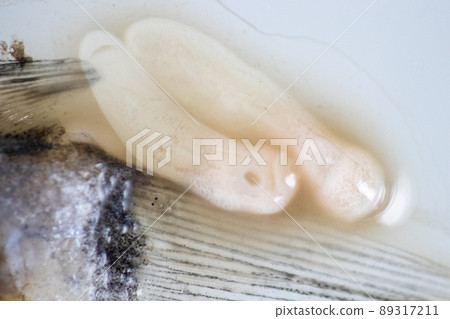 Parasitic (Clinostomum sp.), Study of Clinostomum sp. under microscope view in laboratory. Parasitic (Clinostomum sp.), Study of Clinostomum sp. under microscope view in laboratory. 89317211