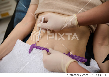 Close-up cosmetologist measures the level of belly fat with caliper and draws lines with white pencil on the woman's abdomen 89333191