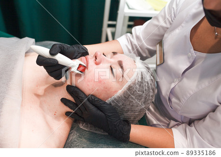 Doctor cosmetologist makes facial massage procedure using a dermo roller. Woman in beauty salon during mesotherapy procedure with mesoscooter.. 89335186