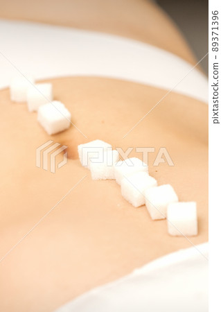 The concept of epilation, waxing. Sugar cubes lying in a row on the abdomen of a young white woman, close up 89371396