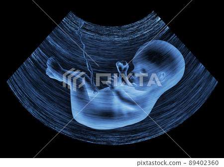 ultrasound baby ultrasound baby 89402360