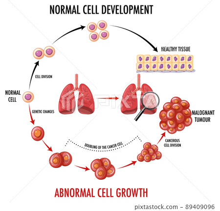 Cancer Development Process Diagram