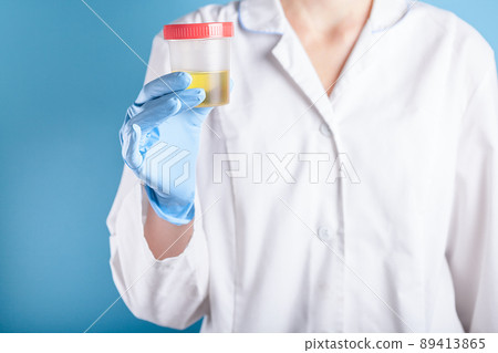 Doctor in white uniform and blue medical gloves holding container for urine analysis. Urine testing for diseases 89413865