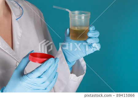 portrait of doctor woman who holds a jar of urine and tube as an idea treatment with urine that is drunk. urinotherapy 89413866