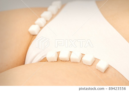 The concept of epilation, waxing, and intimate hygiene. Sugar cubes lying in a row on the bikini zone of a young white woman, close up 89423556