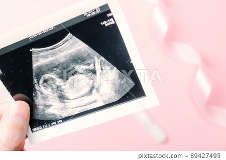 Ultrasound picture pregnant baby photo. Woman hands holding ultrasound pregnancy image on pink background. Concept of pregnancy, maternity, expectation for baby birth. 89427495