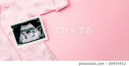 Ultrasound picture pregnant baby photo. Fashion cute baby cloth with ultrasound pregnancy image on pink background. Pregnancy, medicine, pharmaceutics, health care and people concept. Ultrasound picture pregnant baby photo. Fashion cute baby cloth with ultrasound pregnancy image on pink background. Pregnancy, medicine, pharmaceutics, health care and people concept. 89454452