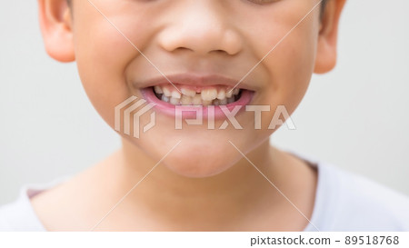 Smilling Asian boy with new upper adult tooth Smilling Asian boy with new upper adult tooth 89518768
