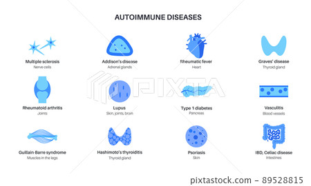 Autoimmune disorders diseases Autoimmune disorders diseases 89528815