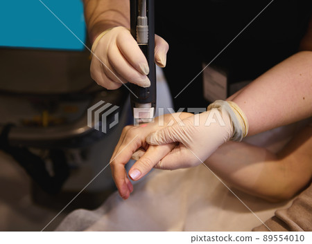 Close-up of professional removal of pigment spots and hair from the hands using a medical laser in a spa clinic Close-up of professional removal of pigment spots and hair from the hands using a medical laser in a spa clinic 89554010