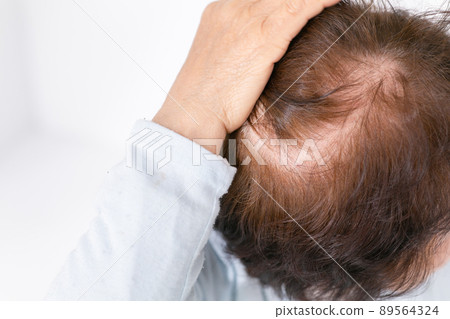 關心頭髮的女性高級稀疏頭髮 關心頭髮的女性高級稀疏頭髮 89564324