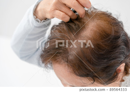 Women who care about hair Senior thinning hair Women who care about hair Senior thinning hair 89564333