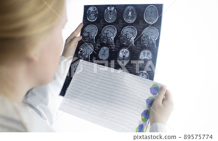 Epileptologist examines patient MRI and electroencephalogram. Concept treating epilepsy and helping people who suffer from this disease. Neurologist at work. Pathology of the brain. Seizure activity Epileptologist examines patient MRI and electroencephalogram. Concept treating epilepsy and helping people who suffer from this disease. Neurologist at work. Pathology of the brain. Seizure activity 89575774