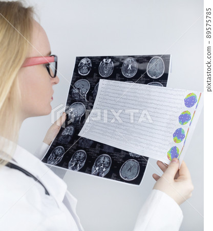 Epileptologist examines patient MRI and electroencephalogram. Concept treating epilepsy and helping people who suffer from this disease. Neurologist at work. Pathology of the brain. Seizure activity 89575785