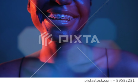 Happy smile. Orthodontic care. Dental correction. Neon blue red color closeup of woman mouth laughing with teeth braces in bokeh light isolated on dark. 89582281